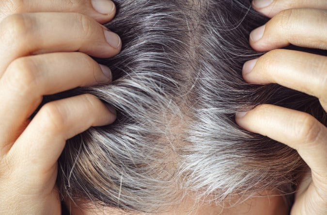 ¿Porque salen las canas y como podemos evitar que se vuelvan amarillas?